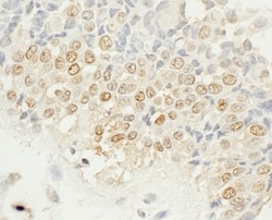 NEK4 Antibody, Novus Biologicals 0.1mL; Unlabeled:Antibodies, Polyclonal